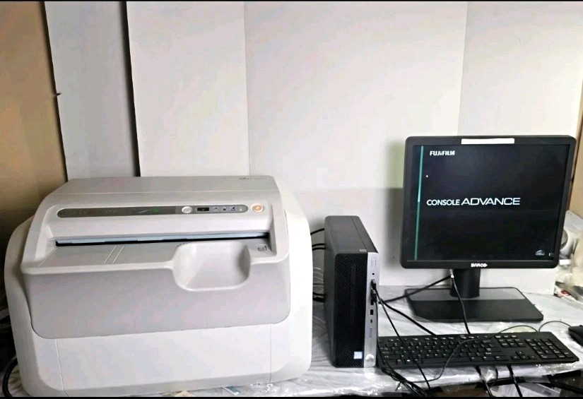 Fujifilm FCR Prima T2 CR-IR 392 W/ Computer & Monitor