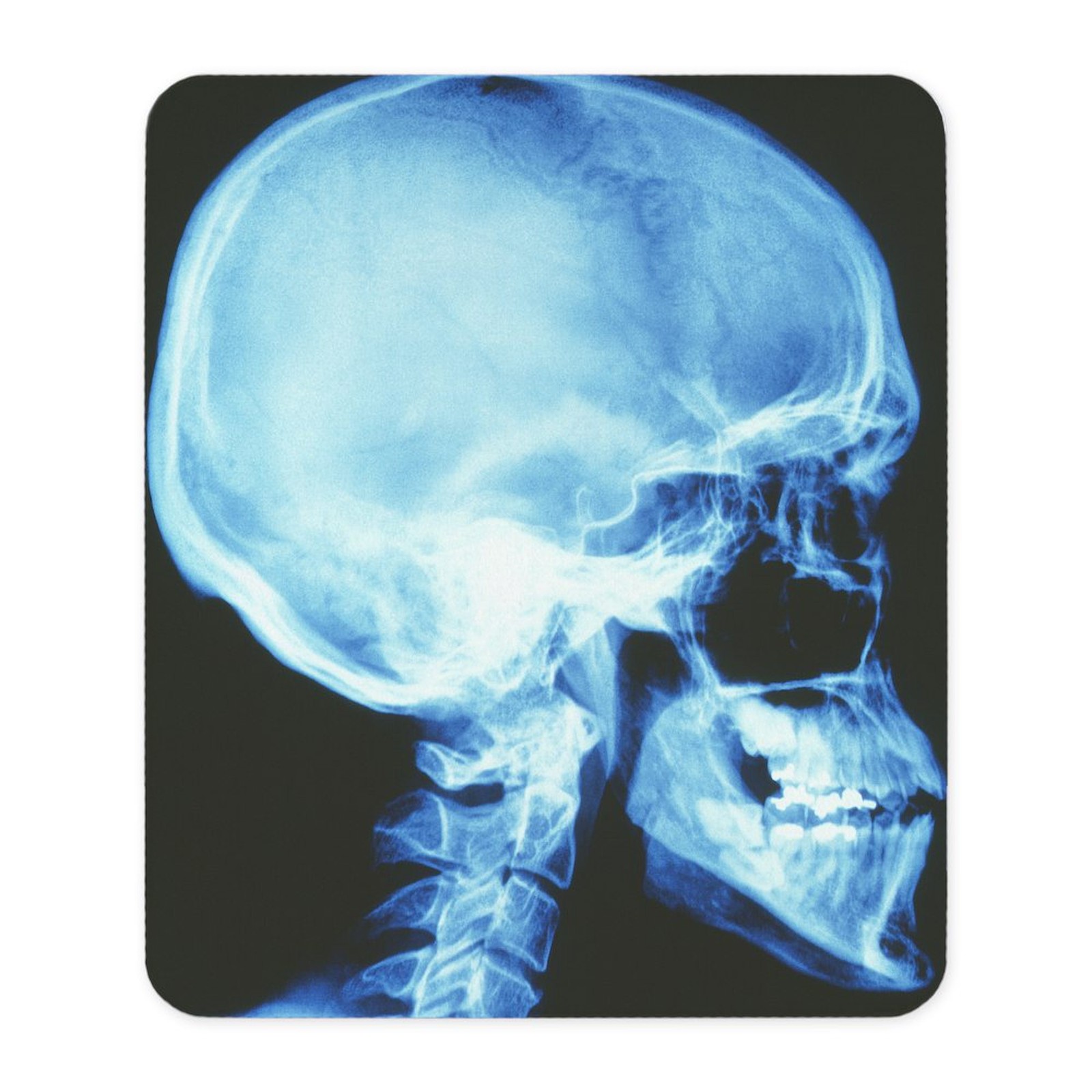CafePress Skull X Ray Non-slip Rubber Mousepad, Gaming Mouse Pad (1158223942)