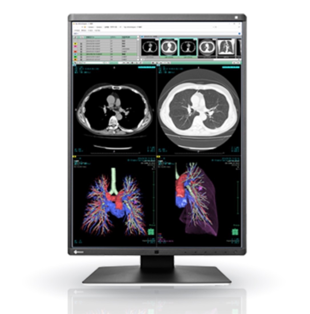 EIZO RadiForce RX360 Monitor